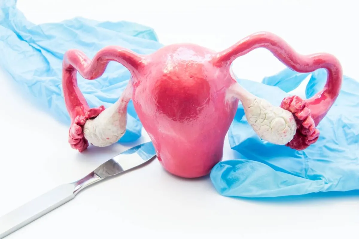 Concept of gynecology surgery