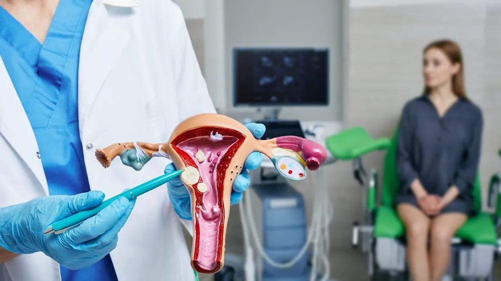 Uterine fibroid, myoma. Gynecologist pointing uterine leiomyomas on anatomical model of uterus