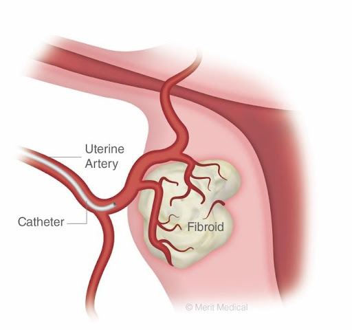 uterine artery
