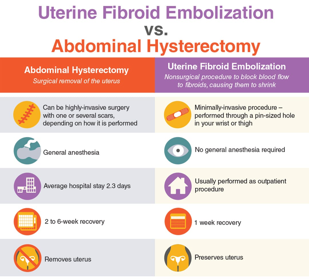 UFE vs Abdominal Hysterectomy