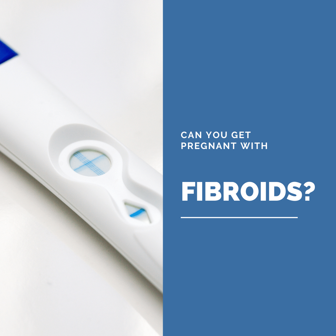 Can You Get Pregnant with Fibroids