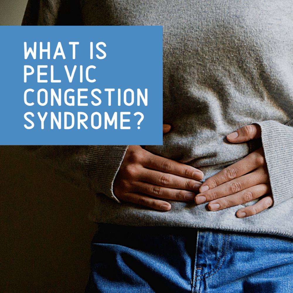 What Is Pelvic Congestion Syndrome New York City 1 Fibroid Center 2921