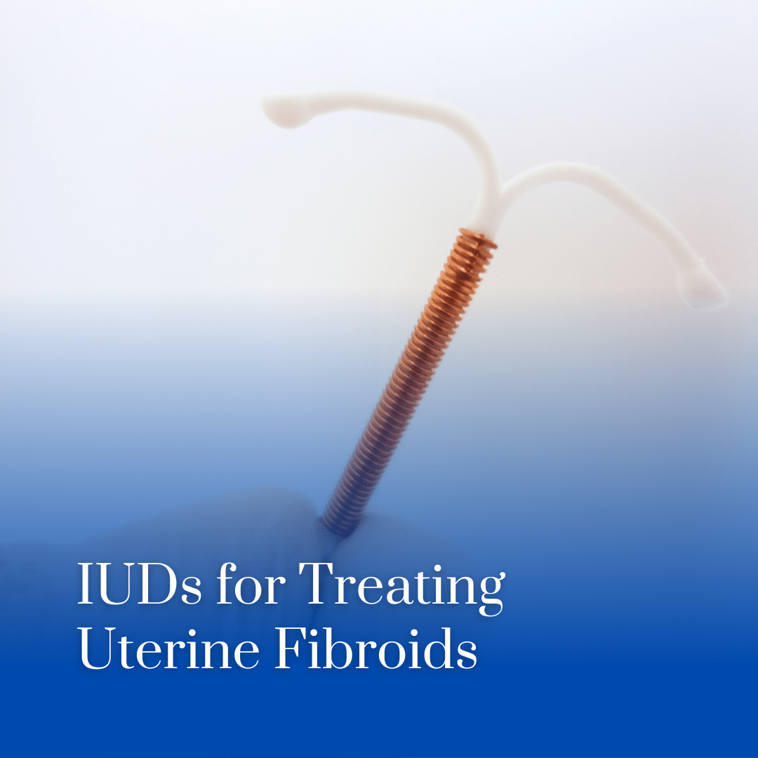 IUDs for Treating Uterine Fibroids