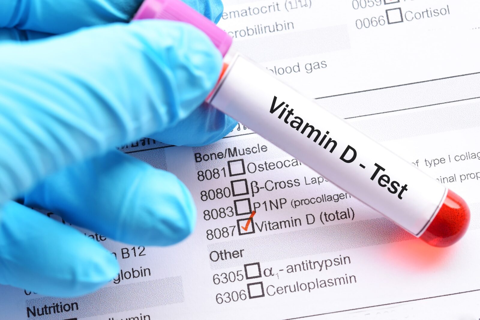 vitamin D blood test vial