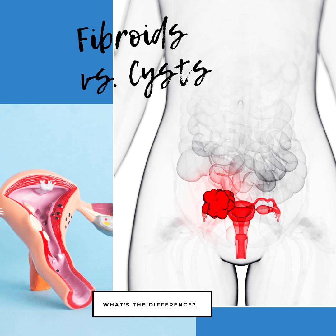 Fibroids vs. Cysts What's the Difference