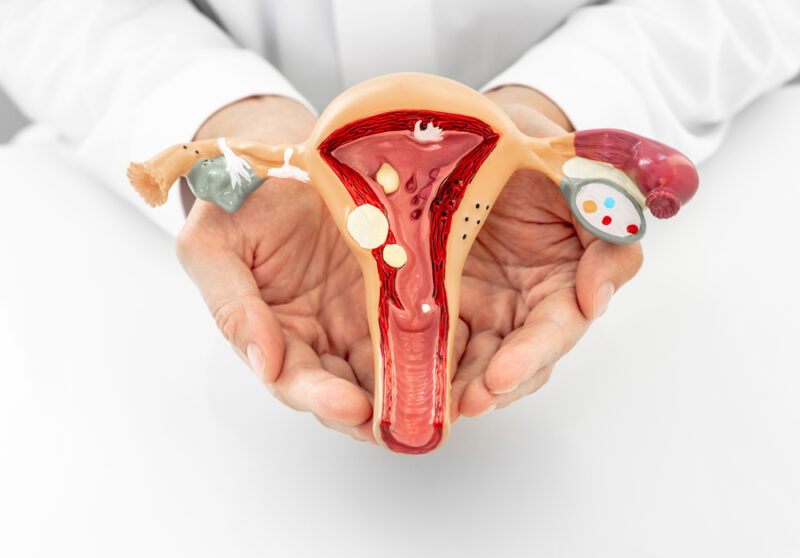 3 Gynecological Issues That UFE Can Treat